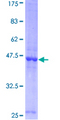 LCN2 / Lipocalin 2 / NGAL Protein - 12.5% SDS-PAGE of human LCN2 stained with Coomassie Blue