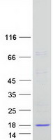 LCN6 Protein - Purified recombinant protein LCN6 was analyzed by SDS-PAGE gel and Coomassie Blue Staining