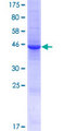 LCN9 Protein - 12.5% SDS-PAGE of human LCN9 stained with Coomassie Blue