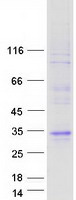 LCN9 Protein - Purified recombinant protein LCN9 was analyzed by SDS-PAGE gel and Coomassie Blue Staining