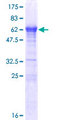 LCORL Protein - 12.5% SDS-PAGE of human LCORL stained with Coomassie Blue