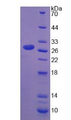 LCP1 / L-Plastin Protein - Recombinant Lymphocyte Cytosolic Protein 1 By SDS-PAGE