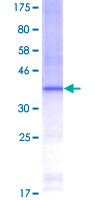 LCT / Lactase Protein - 12.5% SDS-PAGE Stained with Coomassie Blue.