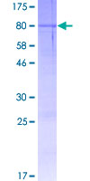 LCTL Protein - 12.5% SDS-PAGE of human LCTL stained with Coomassie Blue