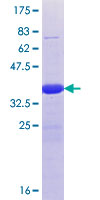LCX / TET1 Protein - 12.5% SDS-PAGE Stained with Coomassie Blue.