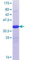 LCX / TET1 Protein - 12.5% SDS-PAGE Stained with Coomassie Blue.