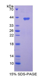 LD78 / CCL3L1 Protein - Recombinant Chemokine C-C-Motif Ligand 3 Like Protein 1 By SDS-PAGE