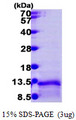 LD78 / CCL3L1 Protein