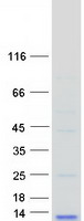 LD78 / CCL3L1 Protein - Purified recombinant protein CCL3L1 was analyzed by SDS-PAGE gel and Coomassie Blue Staining