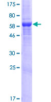LDAH Protein - 12.5% SDS-PAGE of human C2orf43 stained with Coomassie Blue