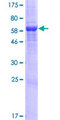 LDAH Protein - 12.5% SDS-PAGE of human C2orf43 stained with Coomassie Blue