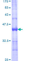 LDB1 / CLIM2 Protein - 12.5% SDS-PAGE Stained with Coomassie Blue.