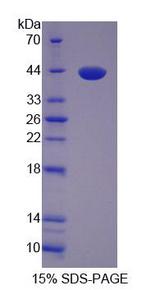 LDB1 / CLIM2 Protein - Recombinant  LIM Domain Binding Protein 1 By SDS-PAGE