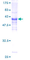 LDB3 / ZASP Protein - 12.5% SDS-PAGE of human LDB3 stained with Coomassie Blue