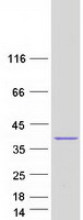 LDB3 / ZASP Protein - Purified recombinant protein LDB3 was analyzed by SDS-PAGE gel and Coomassie Blue Staining