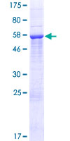 LDHA / LDH1 Protein - 12.5% SDS-PAGE of human LDHA stained with Coomassie Blue