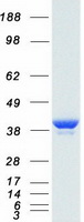 LDHA / LDH1 Protein - Purified recombinant protein LDHA was analyzed by SDS-PAGE gel and Coomassie Blue Staining