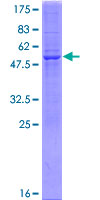 LDHAL6A Protein - 12.5% SDS-PAGE of human LDHAL6A stained with Coomassie Blue
