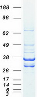 LDHB / Lactate Dehydrogenase B Protein - Purified recombinant protein LDHB was analyzed by SDS-PAGE gel and Coomassie Blue Staining
