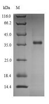 LDHC / Lactate Dehydrogenase C Protein - (Tris-Glycine gel) Discontinuous SDS-PAGE (reduced) with 5% enrichment gel and 15% separation gel.