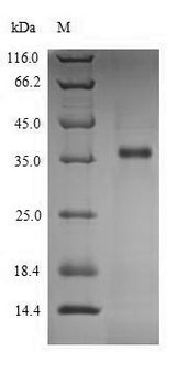 LDHC / Lactate Dehydrogenase C Protein - (Tris-Glycine gel) Discontinuous SDS-PAGE (reduced) with 5% enrichment gel and 15% separation gel.