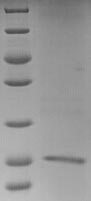 LDHC / Lactate Dehydrogenase C Protein - (Tris-Glycine gel) Discontinuous SDS-PAGE (reduced) with 5% enrichment gel and 15% separation gel.