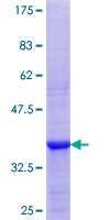 LDHC / Lactate Dehydrogenase C Protein - 12.5% SDS-PAGE Stained with Coomassie Blue.