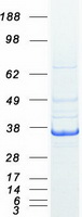 LDHC / Lactate Dehydrogenase C Protein - Purified recombinant protein LDHC was analyzed by SDS-PAGE gel and Coomassie Blue Staining