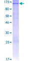 LDLR / LDL Receptor Protein - 12.5% SDS-PAGE of human LDLR stained with Coomassie Blue
