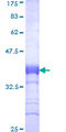 LDLR / LDL Receptor Protein - 12.5% SDS-PAGE Stained with Coomassie Blue.