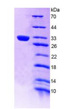 LDLR / LDL Receptor Protein - Recombinant Low Density Lipoprotein Receptor By SDS-PAGE