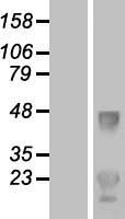 LDLRAD1 Protein - Western validation with an anti-DDK antibody * L: Control HEK293 lysate R: Over-expression lysate