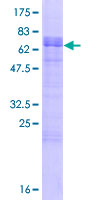 LDLRAD3 Protein - 12.5% SDS-PAGE of human LDLRAD3 stained with Coomassie Blue