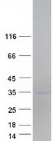 LDLRAD4 / C18orf1 Protein - Purified recombinant protein LDLRAD4 was analyzed by SDS-PAGE gel and Coomassie Blue Staining