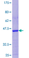 LDOC1 Protein - 12.5% SDS-PAGE of human LDOC1 stained with Coomassie Blue
