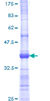 LDOC1 Protein - 12.5% SDS-PAGE Stained with Coomassie Blue.