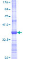 LDOC1 Protein - 12.5% SDS-PAGE Stained with Coomassie Blue.