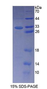 LDOC1 Protein - Recombinant  Leucine Zipper, Down Regulated In Cancer 1 By SDS-PAGE