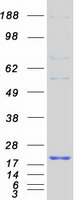 LDOC1 Protein - Purified recombinant protein LDOC1 was analyzed by SDS-PAGE gel and Coomassie Blue Staining