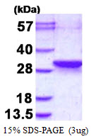 LDOC1L Protein