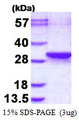 LDOC1L Protein