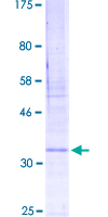 LEAP2 Protein - 12.5% SDS-PAGE of human LEAP2 stained with Coomassie Blue
