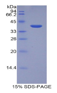 LEAP2 Protein - Recombinant Liver Expressed Antimicrobial Peptide 2 By SDS-PAGE