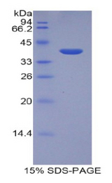 LEAP2 Protein - Recombinant Liver Expressed Antimicrobial Peptide 2 By SDS-PAGE