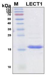 LECT1 / Chondromodulin-I Protein - SDS-PAGE under reducing conditions and visualized by Coomassie blue staining