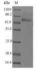 LECT1 / Chondromodulin-I Protein - (Tris-Glycine gel) Discontinuous SDS-PAGE (reduced) with 5% enrichment gel and 15% separation gel.