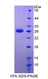 LECT1 / Chondromodulin-I Protein - Recombinant Leukocyte Cell Derived Chemotaxin 1 By SDS-PAGE