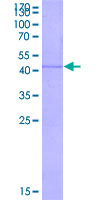 LECT2 Protein - 12.5% SDS-PAGE of human LECT2 stained with Coomassie Blue