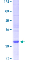 LECT2 Protein - 12.5% SDS-PAGE Stained with Coomassie Blue.