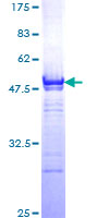 LEF1 Protein - 12.5% SDS-PAGE Stained with Coomassie Blue.